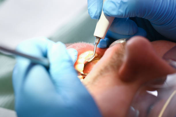 Best Pediatric Emergency Dentist in Wildwood, MO