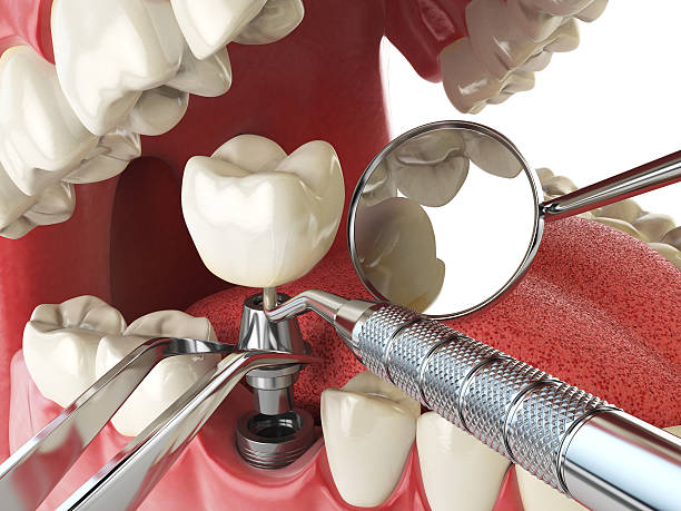 Trusted MO Emergency Dentist Experts